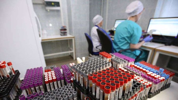 Вчені з'ясували, яка аномальна патологія веде до смерті при коронавірусі