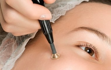 Простий спосіб допомагає позбутися бородавок