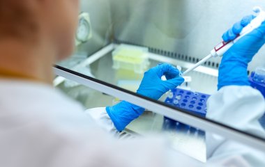 Вчені розробили тест, що визначає ступеня розвитку серцевих захворювань