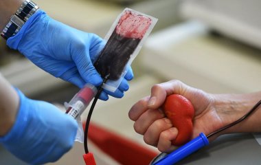 Лікар пояснила зв'язок між групою крові та проблемами із серцем
