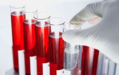 Лікар пояснив значення групи крові для здоров'я