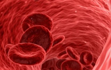 Експерт пояснив, через що судини втрачають еластичність