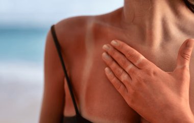 Дерматологи розповіли, що і чому потрібно їсти, щоб уберегтися від сонця та знизити ризик раку шкіри
