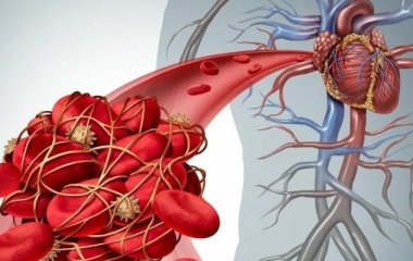 Кардіолог розповів, як зовнішній вигляд видає поразку серця та судин.