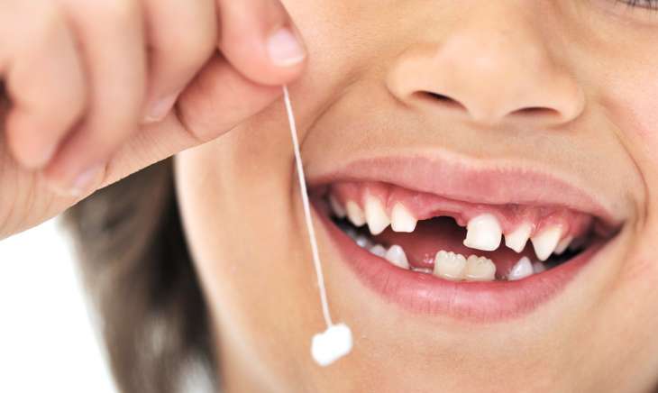 4 причины почему у ребенка крошатся зубы