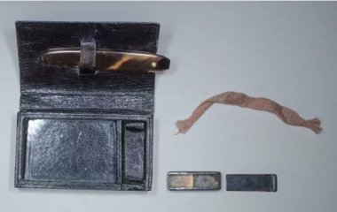Вчені з'ясували, чим щеплювали від віспи два сторіччя тому