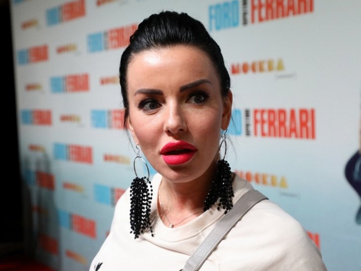 Юлия Волкова призналась, что «перекроила» лицо после домашнего насилия