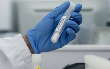 Генна інженерія може врятувати від паразитів