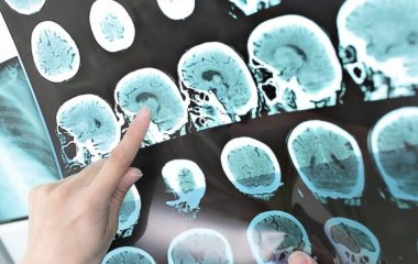 Вчені назвали корисну властивість холоду