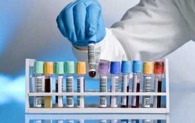 Усім, кому за 40: які аналізи вам потрібно обов'язково здати цього року