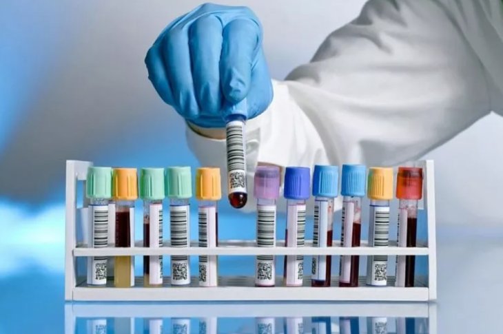 Усім, кому за 40: які аналізи вам потрібно обов'язково здати цього року