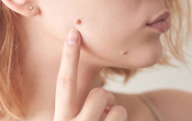 Зміни зі шкірою вказують на небезпечні внутрішні хвороби