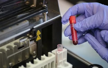 Лікар розповіла про проблему діагностики раку молочної залози