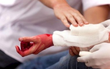 Як швидко зупинити кровотечу