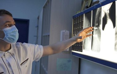 Вчені назвали ознаку ранньої смерті у жінок