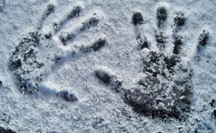 Що робити, якщо постійно мерзнуть руки та ноги
