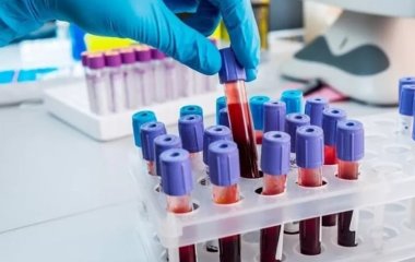 Вчені назвали найменш схильну до раку групу крові