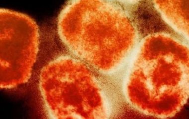 Ученые обнаружили новое опасное последствие оспы обезьян для здоровья