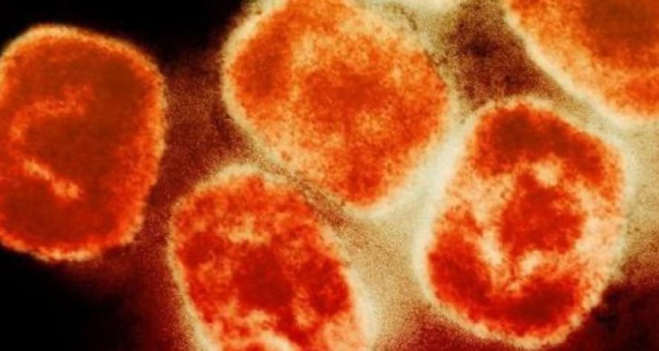 Ученые обнаружили новое опасное последствие оспы обезьян для здоровья