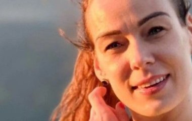 Жінка приголомшила, як збільшення губ врятувало їй життя: що сталося після філера (фото)