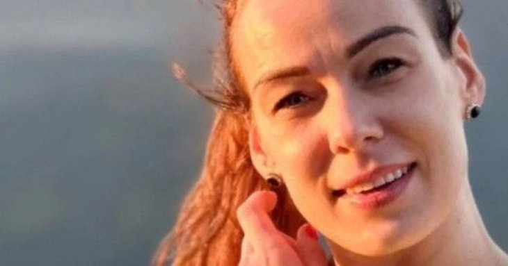 Жінка приголомшила, як збільшення губ врятувало їй життя: що сталося після філера (фото)