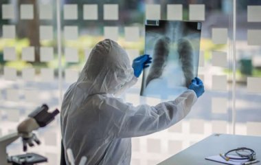 Медики объяснили, что провоцирует плеврит и когда вызывать скорую помощь