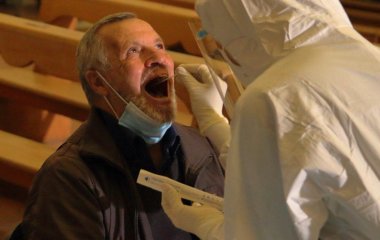 Імунолог перерахував хвороби, які можна помітити за станом ротової порожнини