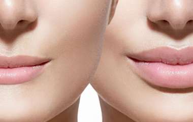 4 распространенных способа увеличения губ