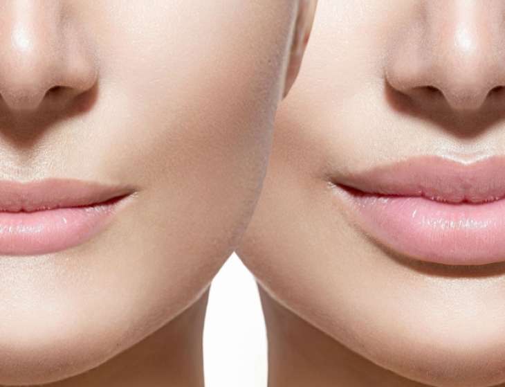 4 распространенных способа увеличения губ