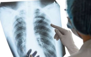 Опасные симптомы туберкулеза перечислили врачи