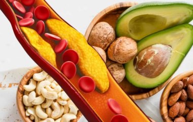 Високий холестерин: продукти, які допоможуть покращити показники