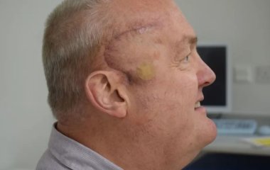 Агресивна пухлина чоловіка зменшилася на 50% за 6 тижнів після першого експериментального лікування