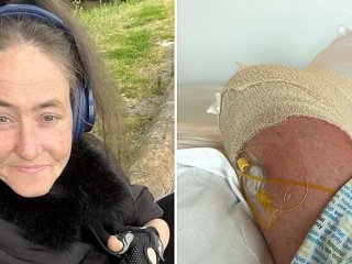 Жінці ампутували ногу після того, як вона наступила на собачий корм (фото)