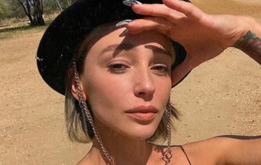 Настю Ивлееву в Африке укусила муха цеце