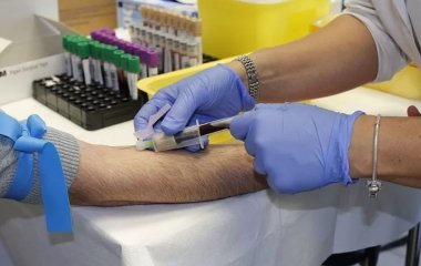 Як до візиту до лікаря зрозуміти, що у вас високий холестерин