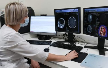 Вчені назвали причину старіння мозку