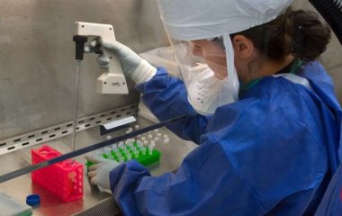 Медики назвали первые признаки высокого холестерина