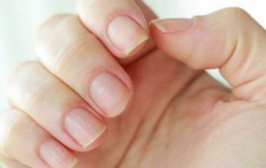 Ногти как отражение здоровья: о каких болезнях свидетельствуют изменения ногтей