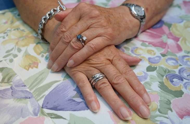 Лікарі розповіли які хвороби можна визначити на вигляд нігтів