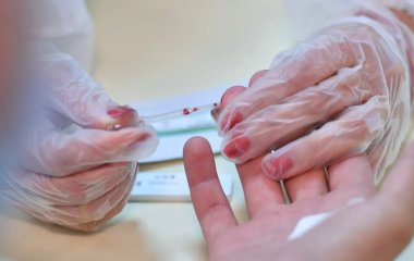 Названо незвичайний симптом, що вказує на проблеми із серцем