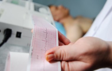 Названо спосіб, як самостійно впоратися з аритмією самостійно