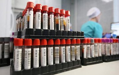 Спокій за серце: аналіз крові виявить ризик тромбозів при «Омікроні»