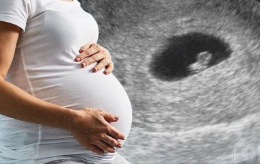 40-річна жінка зробила операцію з підтяжки живота, не знаючи, що вагітна: чим це закінчилося