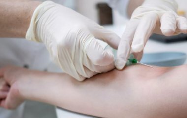 Названо дві деталі, що вказують на високий рівень холестерину