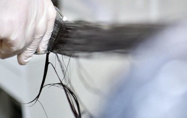 Лікар пояснила, як зупинити випадання волосся після коронавірусу