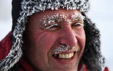 Врач-трихолог объяснила важность ношения шапки в минусовую температуру