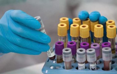 Вчені виявили зв'язок між групою крові та серцевим нападом