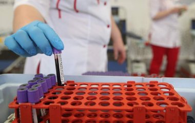 Вчені розробили новий спосіб діагностики гіпертонії на ранніх стадіях