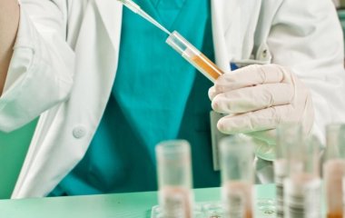 Японські вчені навчилися виявляти рак мозку на ранніх етапах сечі
