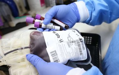 Медики выяснили, как группа крови влияет на склонность к тромбам